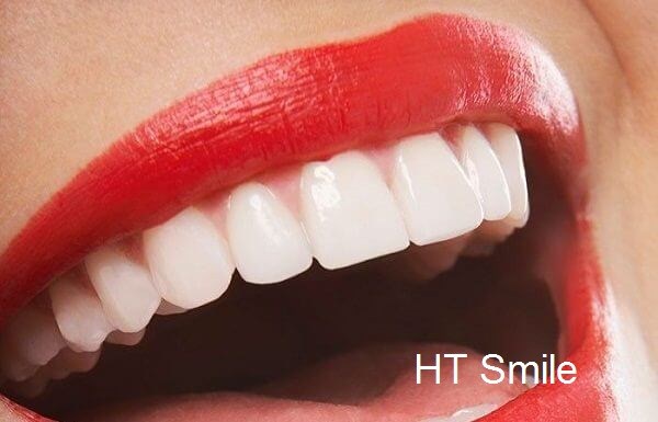 Răng sứ HT Smile